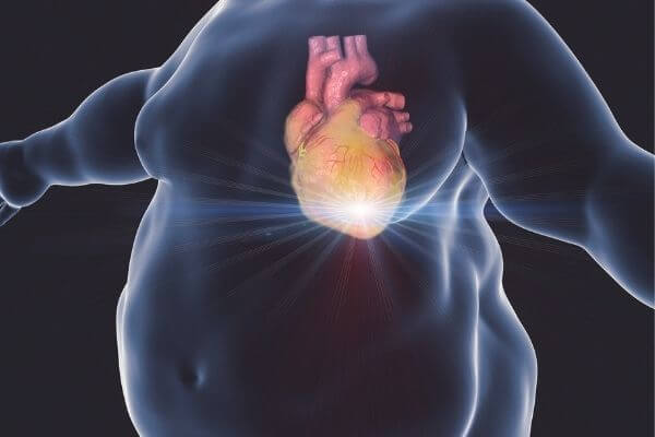 el corazón sufre a causa de la obesidad mórbida