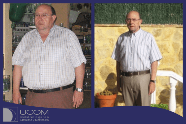 Antes y después de la reducción de estómago de L.A. Ramos